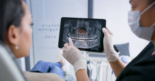 Licensed Tooth Extraction service in Brisbane, CA - Smile Center Dentistry